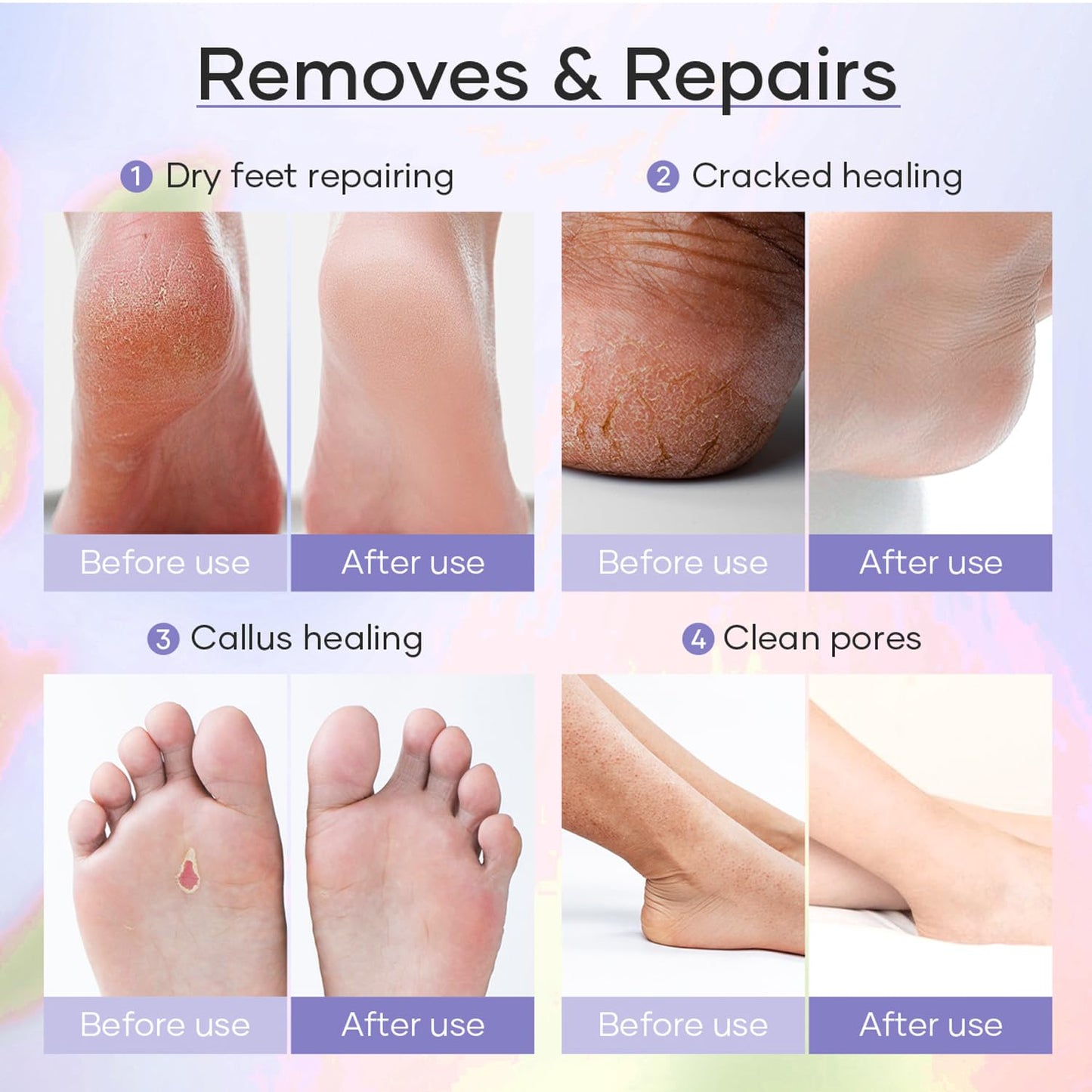 Epsom Salt Soak, Callus Remover Gel, Extreme Sugar Scrub, Collagen Mask & Shea Butter Lotion – Professional Spa Foot Care System 5 Step Luxury Pedicure Kit. Orange 03 Set