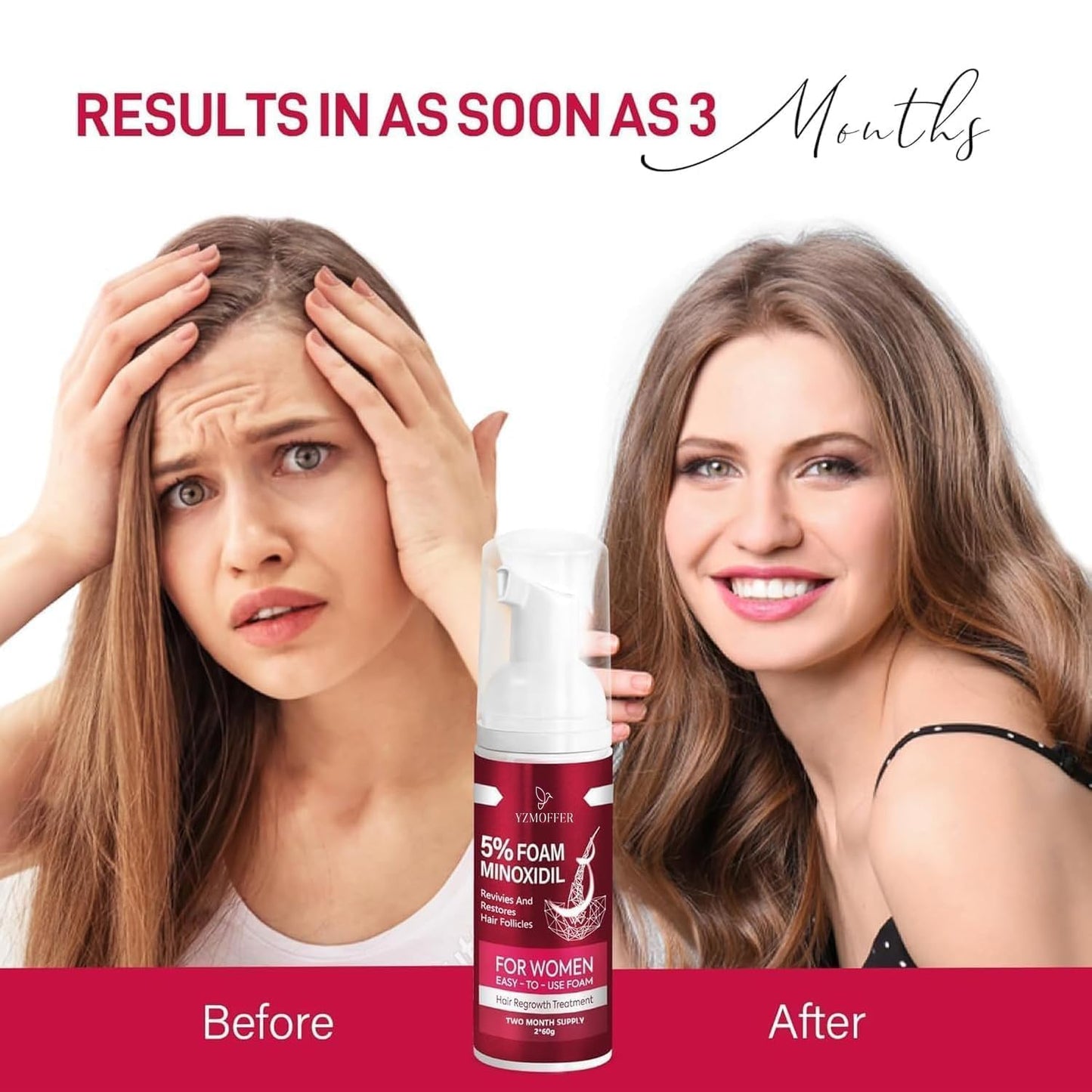 5% Minoxidil Foam for Women Hair Growth: Hair Regrowth Treatment for Women, Reduce Hair Thinning & Hair Loss, Nourish Scalp, Thicker & Fuller Hair, 2 x 60g (2-Month Supply)