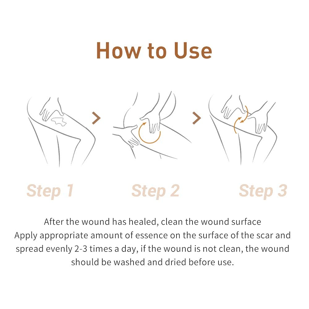 Acne Scar Removal Cream Stretch Marks Face Skin Cream Shrink Pores Gel-Fade Scar Marks Acne Skin Care (Packaging Upgrade) VeniCare