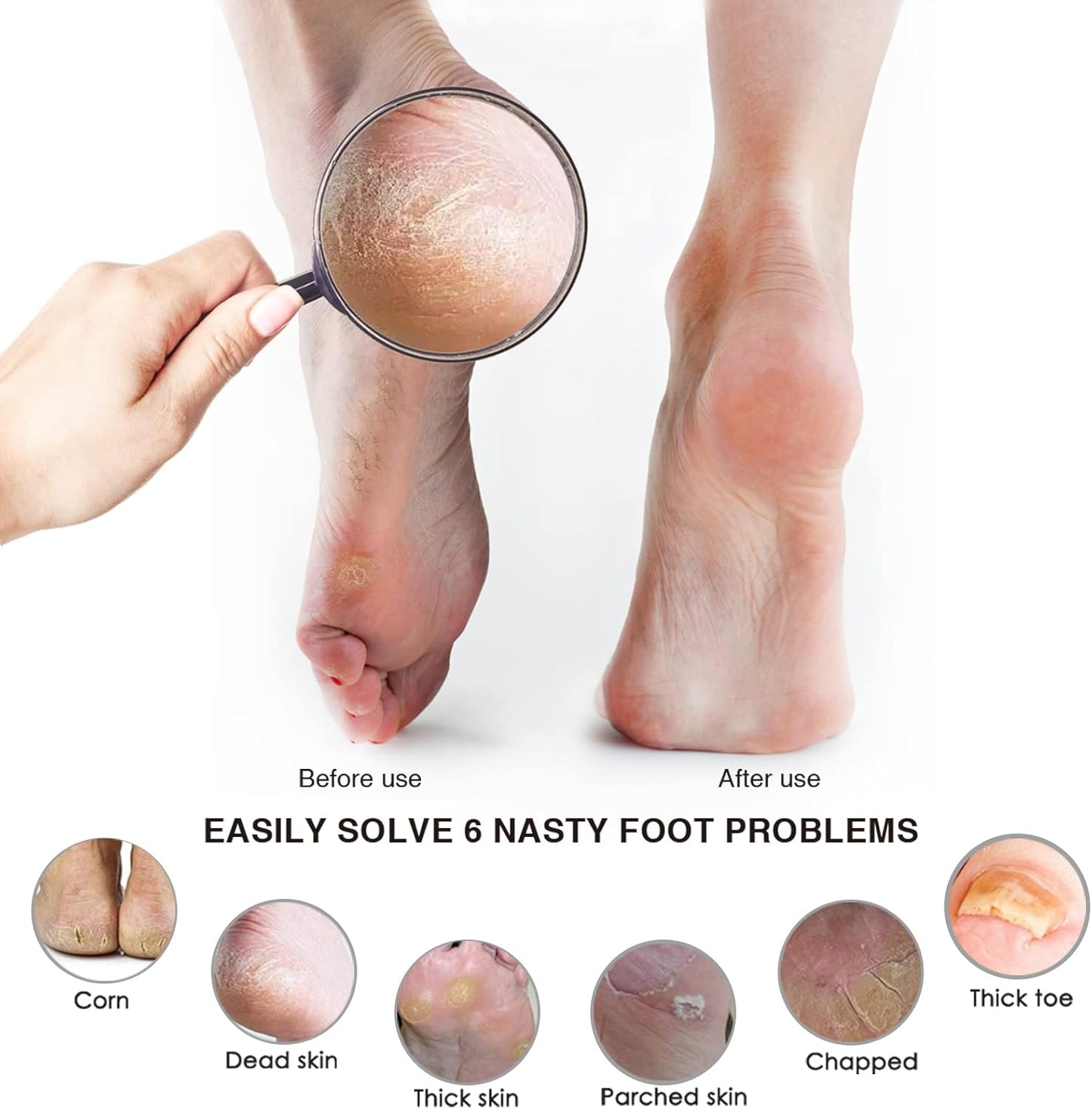 Pumice Stone Foot File (2-Pack), Wooden Handle Foot Scrubber & Callus Remover for Dry, Rough Skin and Corns Pedicure