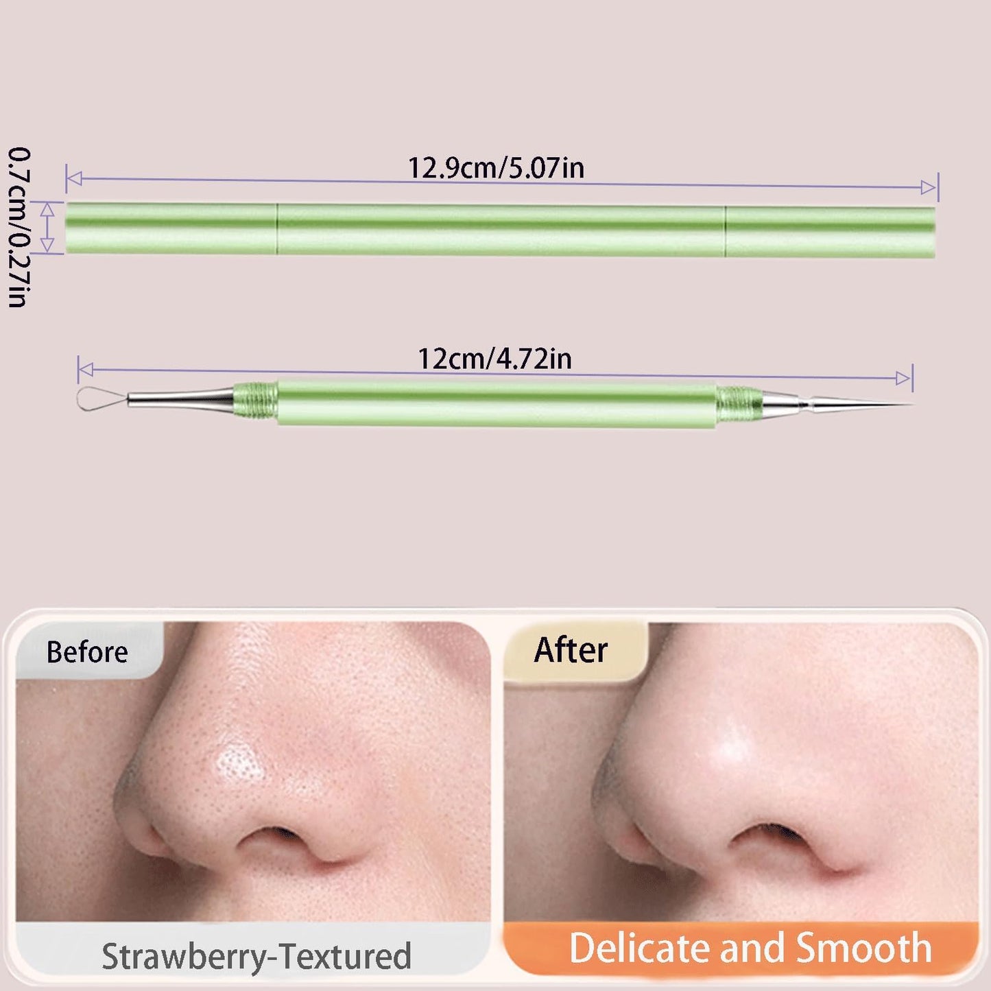 2-in-1 Professional Stainless Steel Acne Removal Needle, Whitehead&Blackhead Remover Tool, Pimples Comedone Extractor Removal Tool, Double Ended Needle with Cap Removal for Nose Face Tools(Rose Gold)