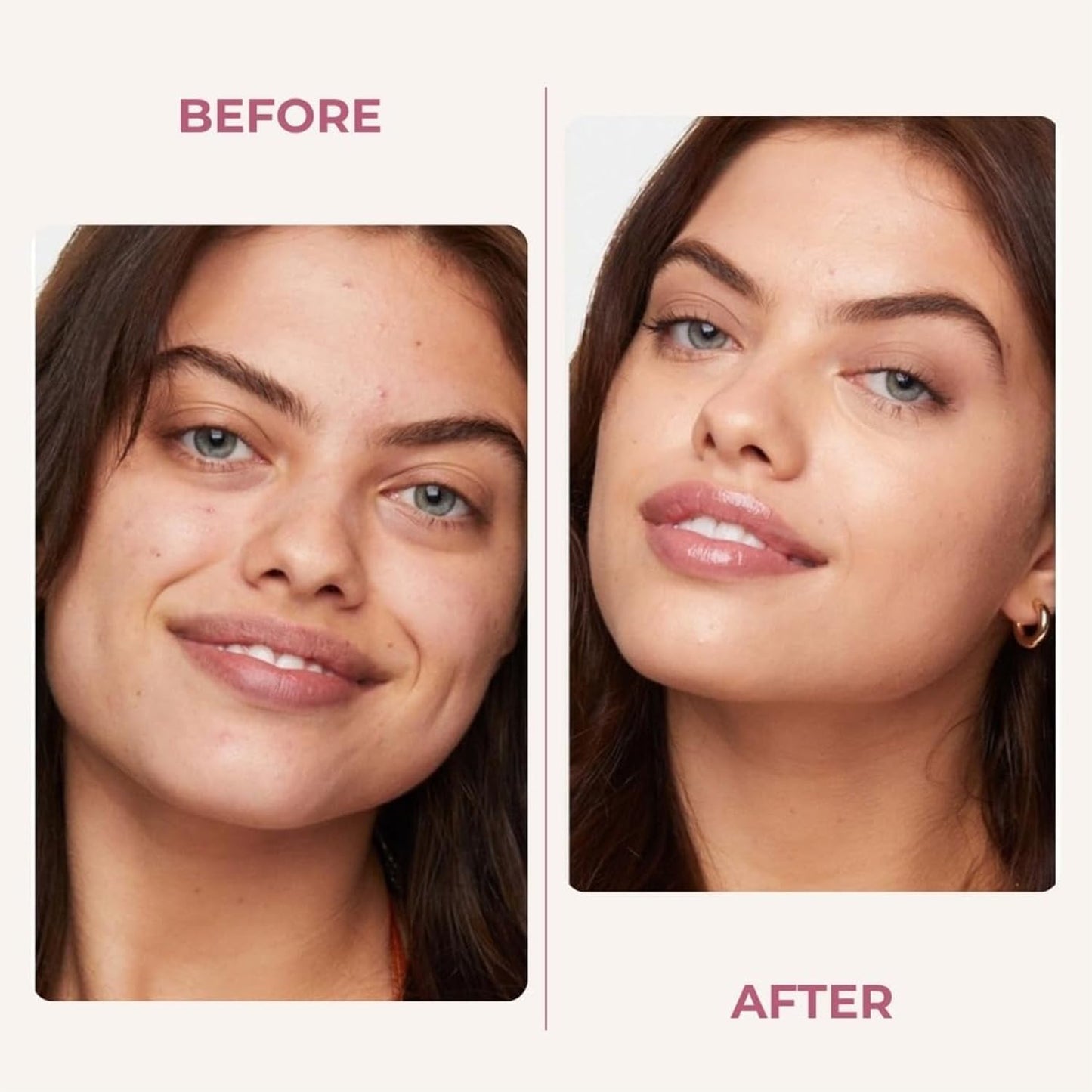 Bee & Beauty Face Moisturizer Cream For Deep Hydration And Skin Repair Natural Nourishing Face Cream With Antioxidants Dry, Oily, Sensitive And All Skin Types With Pure Manuka Honey