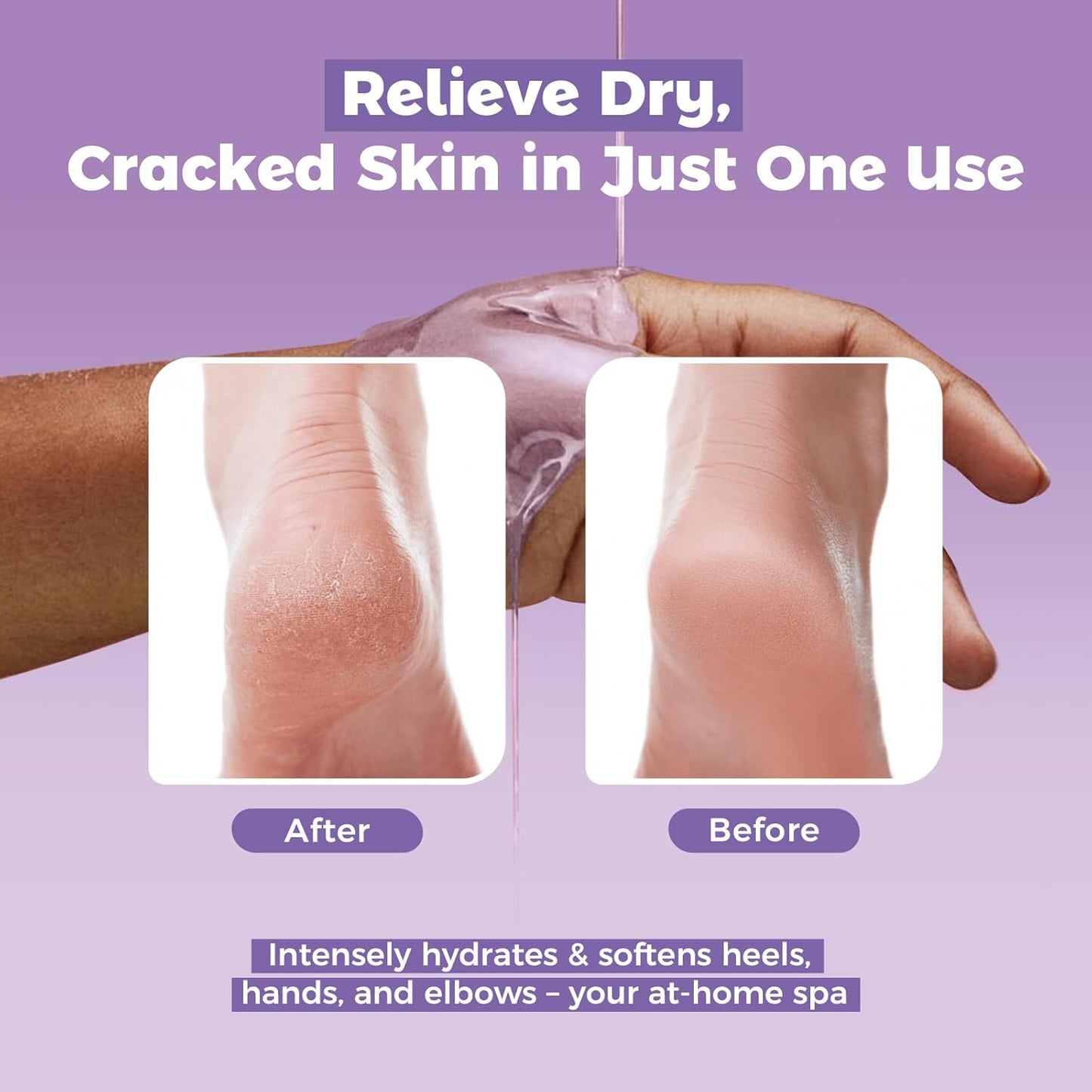 Paraffin Wax Refills 10 Packs for Paraffin Wax Bath Machine - for Dry Cracked Skin on Hands, Feet, Elbows - Moisturizing Hydration to Relieve Stiff Muscles & Joints (Lavender)