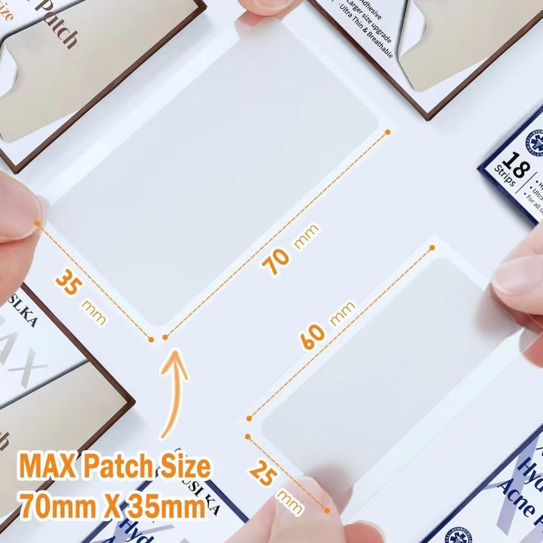 AUSLKA Large Blemish Zit Patches XL - 20 Strips - Hydrocolloid Dots -Blemishes Patch - Zit Breakouts - Blemishes Stickers - Max Size