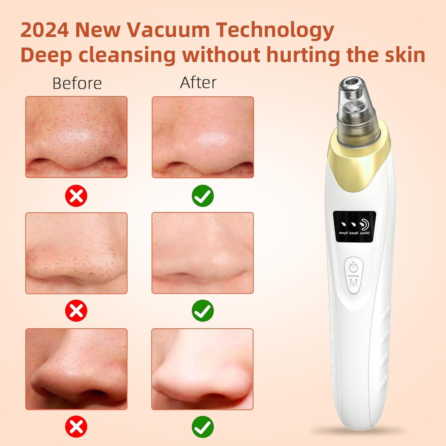 2025 Pore Vacuum, USB Rechargeable Blackhead Remover Vacuum,3 Levels Adjustable Pore Vacuum Blackhead Remover, with 5 Suction Power,6 Probes,Face Vacuum Pore Cleanser for Women & Men-Gold