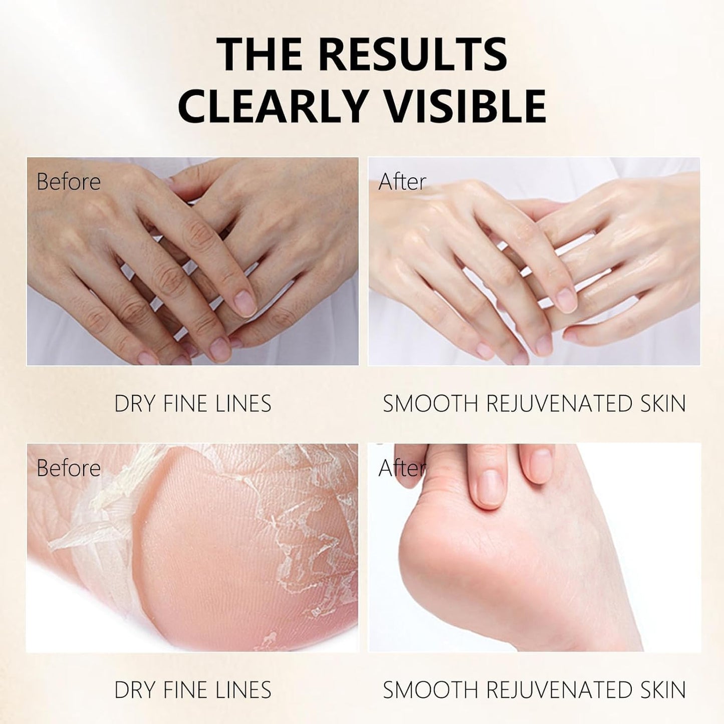 Hydrating Hand Foot Masks Set for Women Men,3 Pack Glove Mask for Dry Hand & 3 Pack Socks Mask for Dry Cracked Feet（Milk）