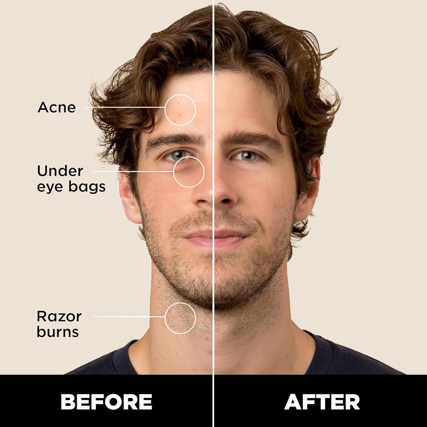 Stryx Concealer Stick Tool for Men, Medium Mahogany - Natural Pigments Hides Imperfections, Acne, Razor Burns, Scars, & Rosacea - Highly Adaptable Shades for Easy, Undetectable Coverage