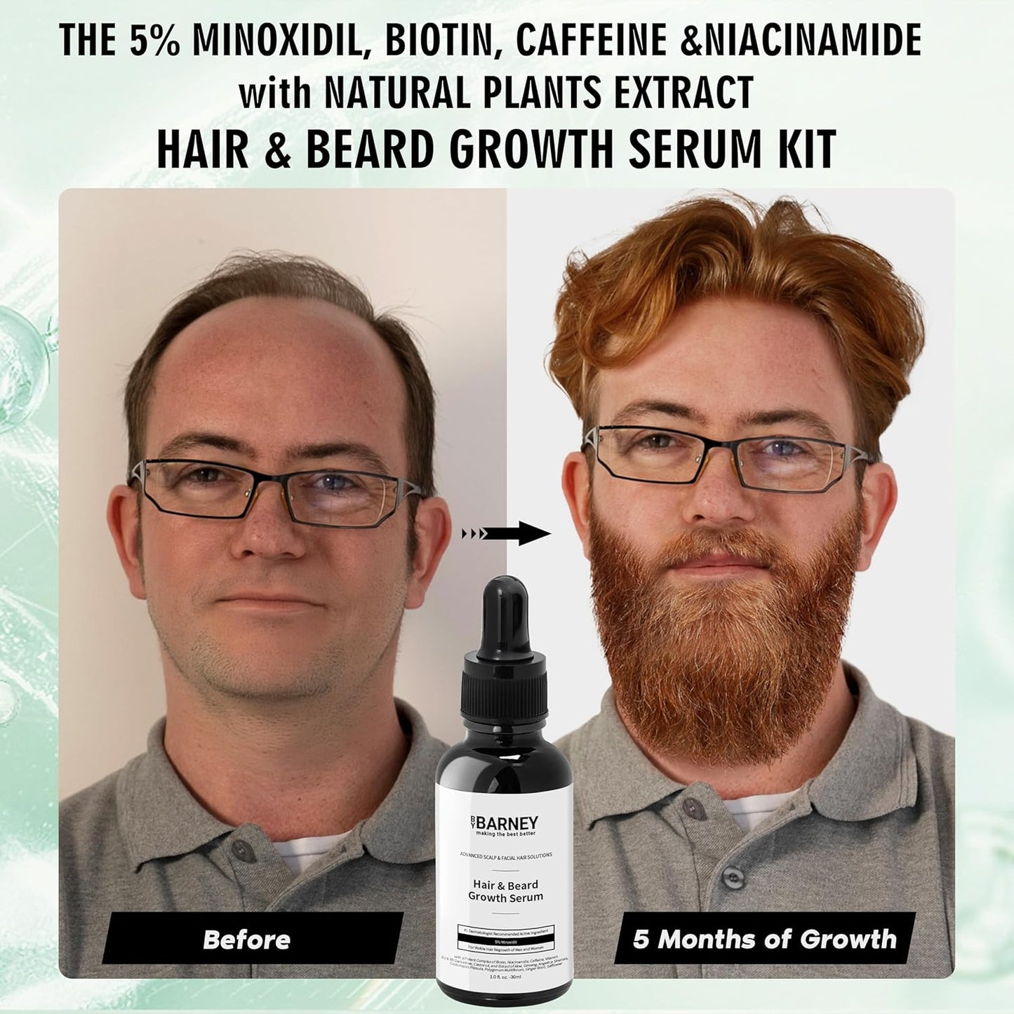 5% Minoxidil Hair and Beard Growth Serum - Natural Extracts, Biotin & Caffeine - Promotes Stronger, Thicker, Fuller Hair and Beard Growth - For Men and Women