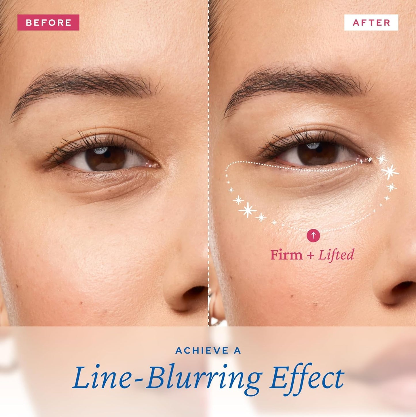 belif Aqua Bomb Lifting Eye Gel | Retinol + Collagen + Peptide for Firming & Plumping | Hyaluronic Acid for Glowy Hydration | Niacinamide for Dark Circles | Korean Skin Care