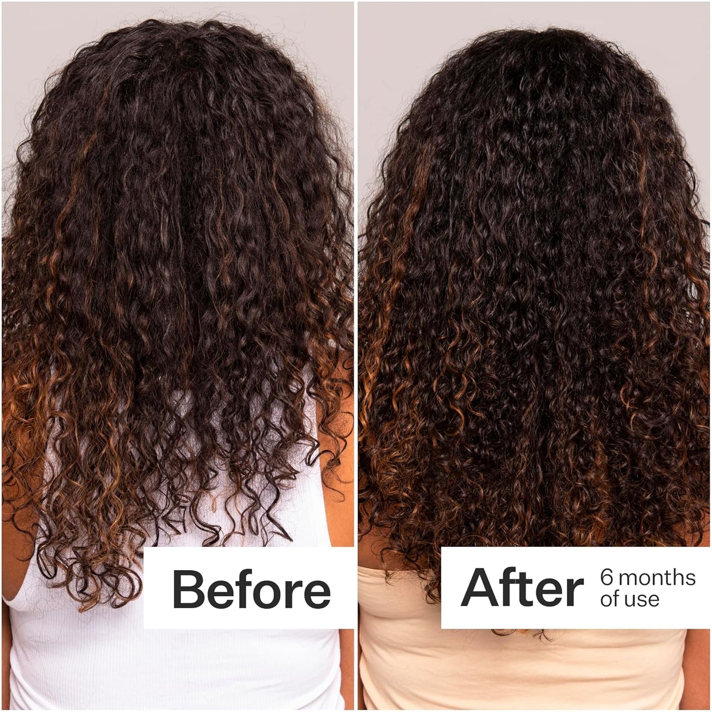 Act+Acre Cold Processed Stem Cell Scalp Serum - Promotes Thicker and Fuller-Looking Hair - Soothes and Hydrates the Scalp - Sulphate and Paraben Free - Aloe Vera for Improved Scalp Health - 1 fl oz.