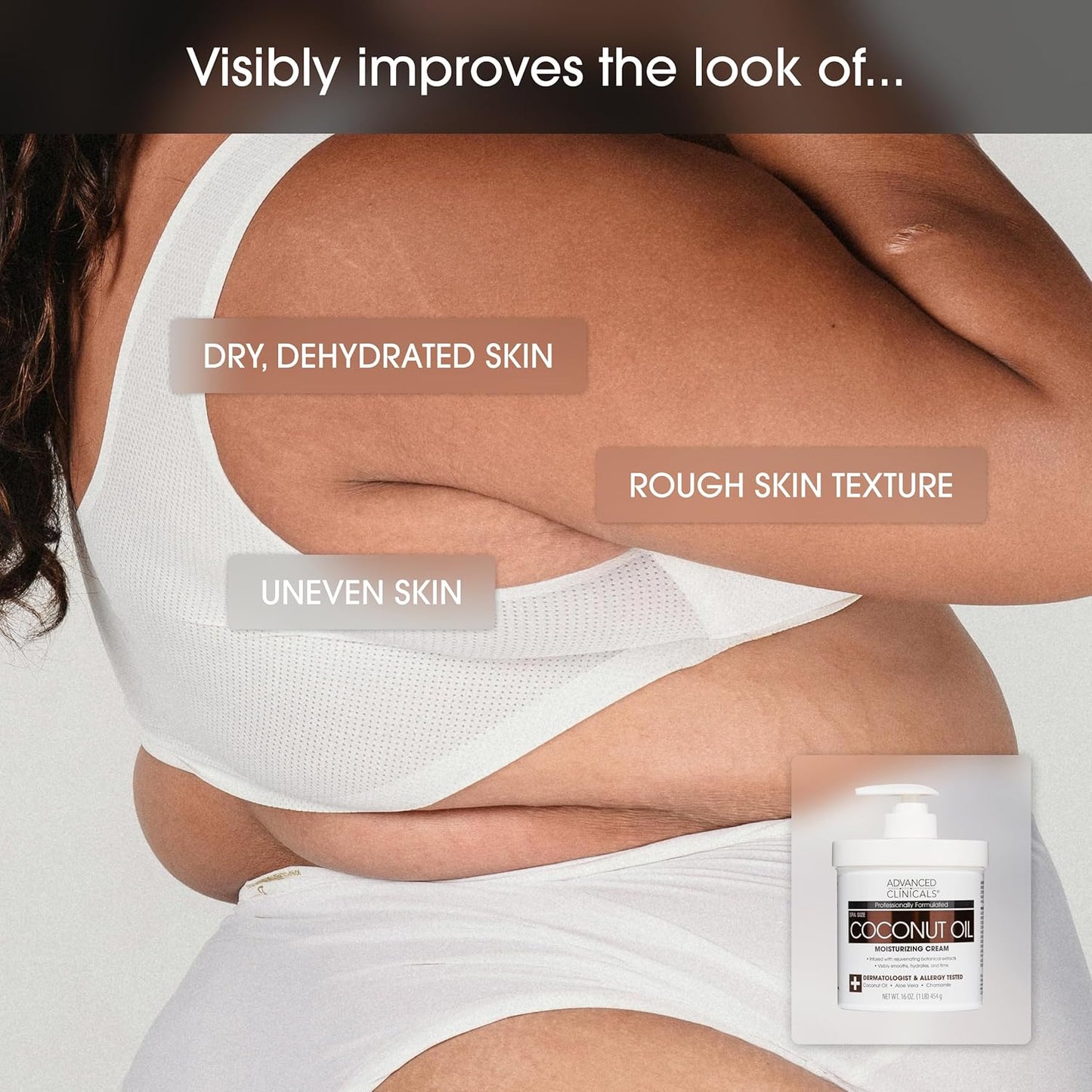 Advanced Clinicals Coconut Oil Body Cream For Women & Men | Hydrating Coconut Lotion For Extremely Dry Skin | Visible Anti Aging Body Butter Skin Care Balm Moisturizer For Hand, Heel, Feet, 16oz, 2PC